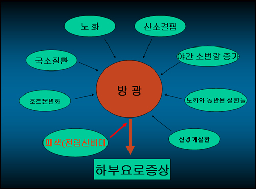 하부 요로 증상과 전립선 비대증 